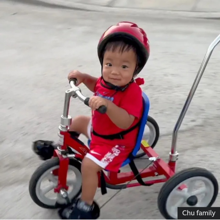 Ground-breaking Gene Therapy for Hunter Syndrome Stuns Doctors