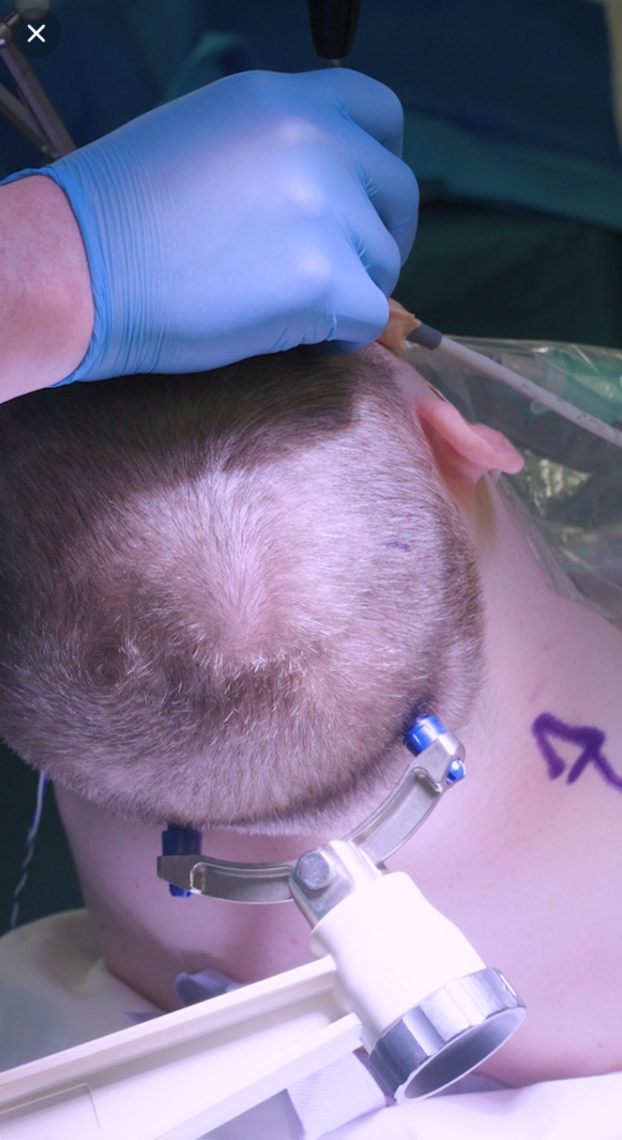 Young Man Donates Brain to Science in Bid to Advance Dementia Research