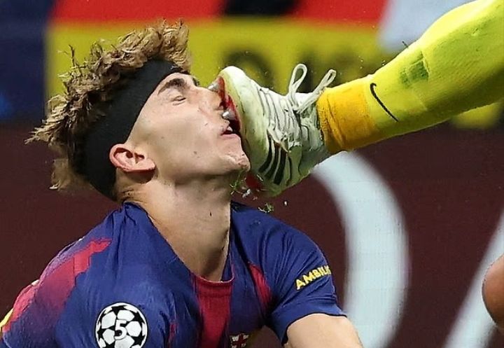 Barcelona Star Left Bloodied After Brutal Kick: Was It Football or a Claymore Moment Gone Too Far?